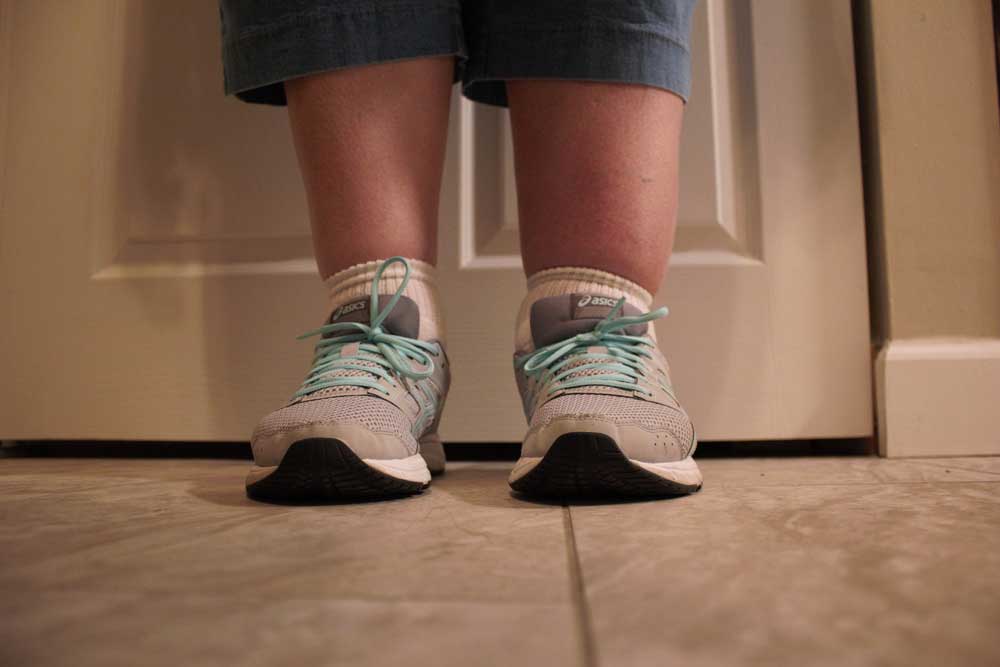 swollen-legs
